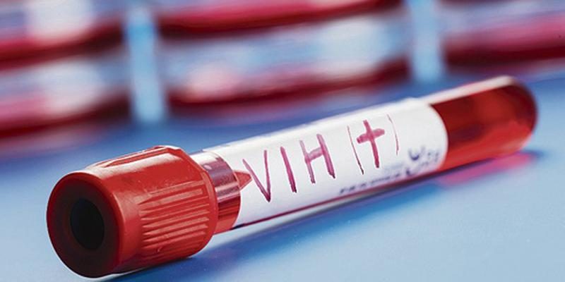 El preocupante aumento de transmisión del VIH en el país